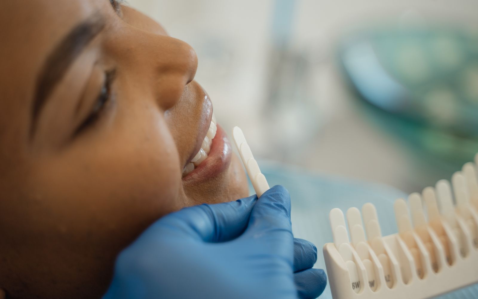 Dentista comparando a cor dos dentes de uma paciente com a escala de cores