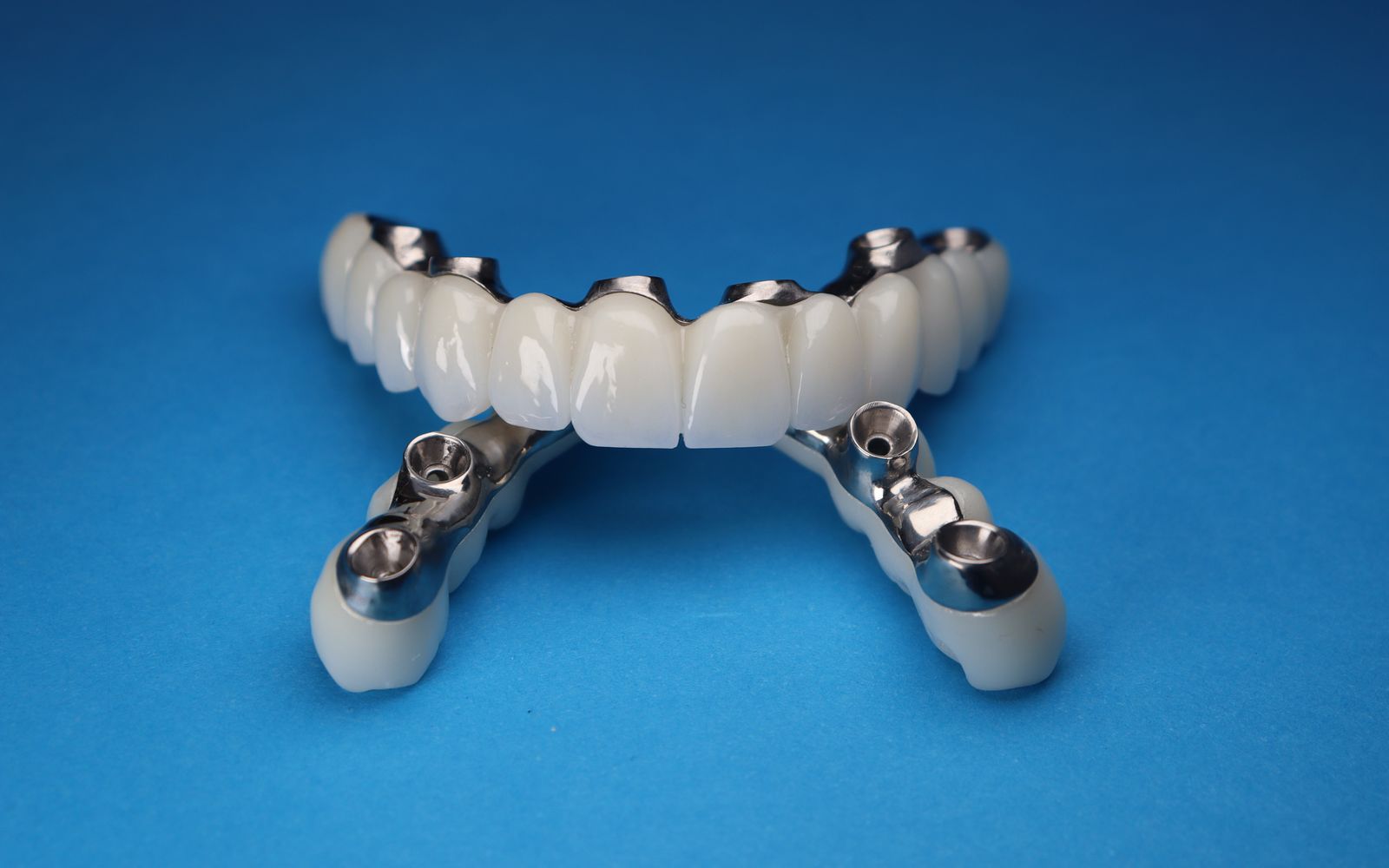 Prótese dentária fixa sobre implantes com estrutura metálica em fundo azul