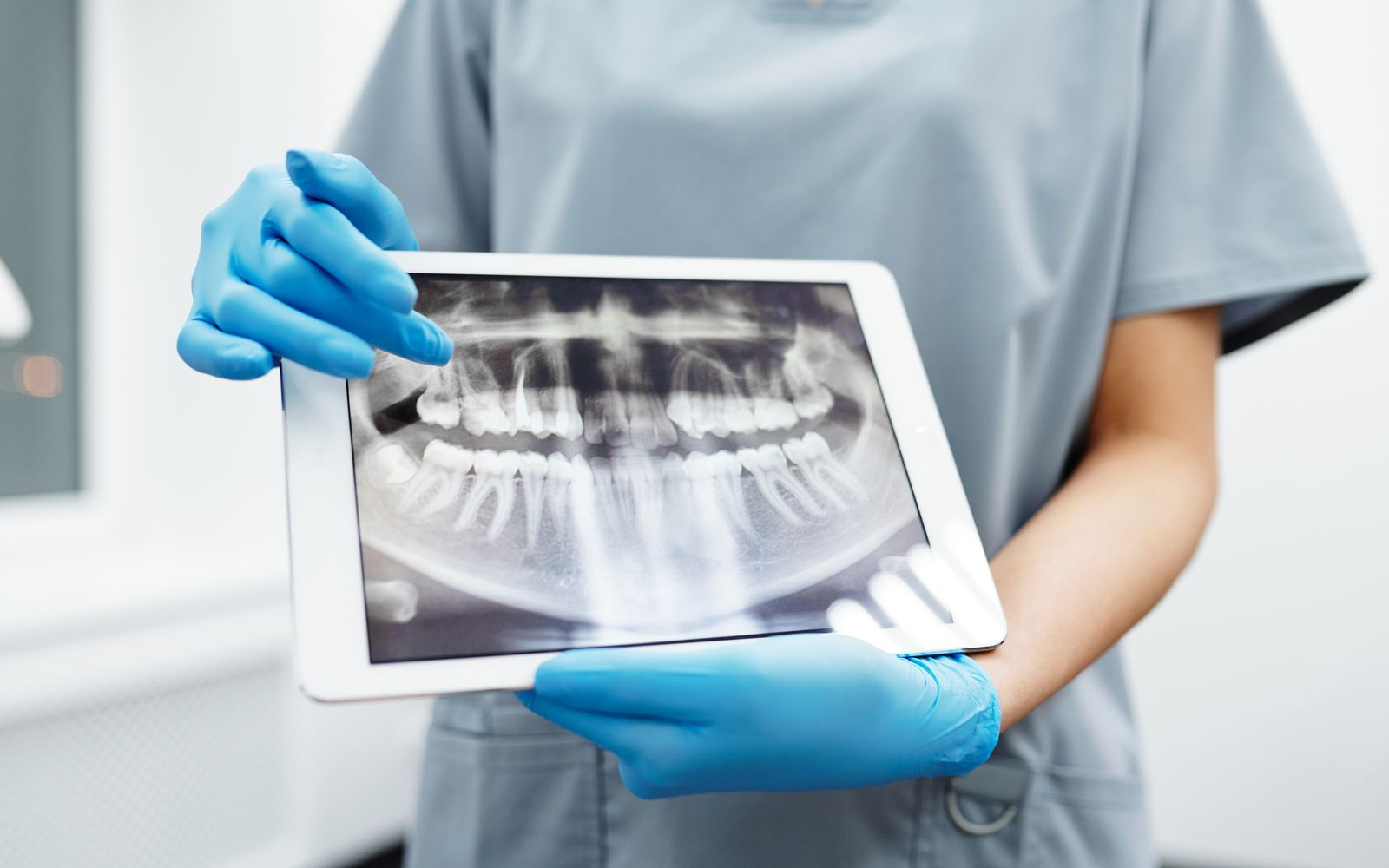 Mãos com luvas segurando tablet com radiografia panorâmica dos dentes