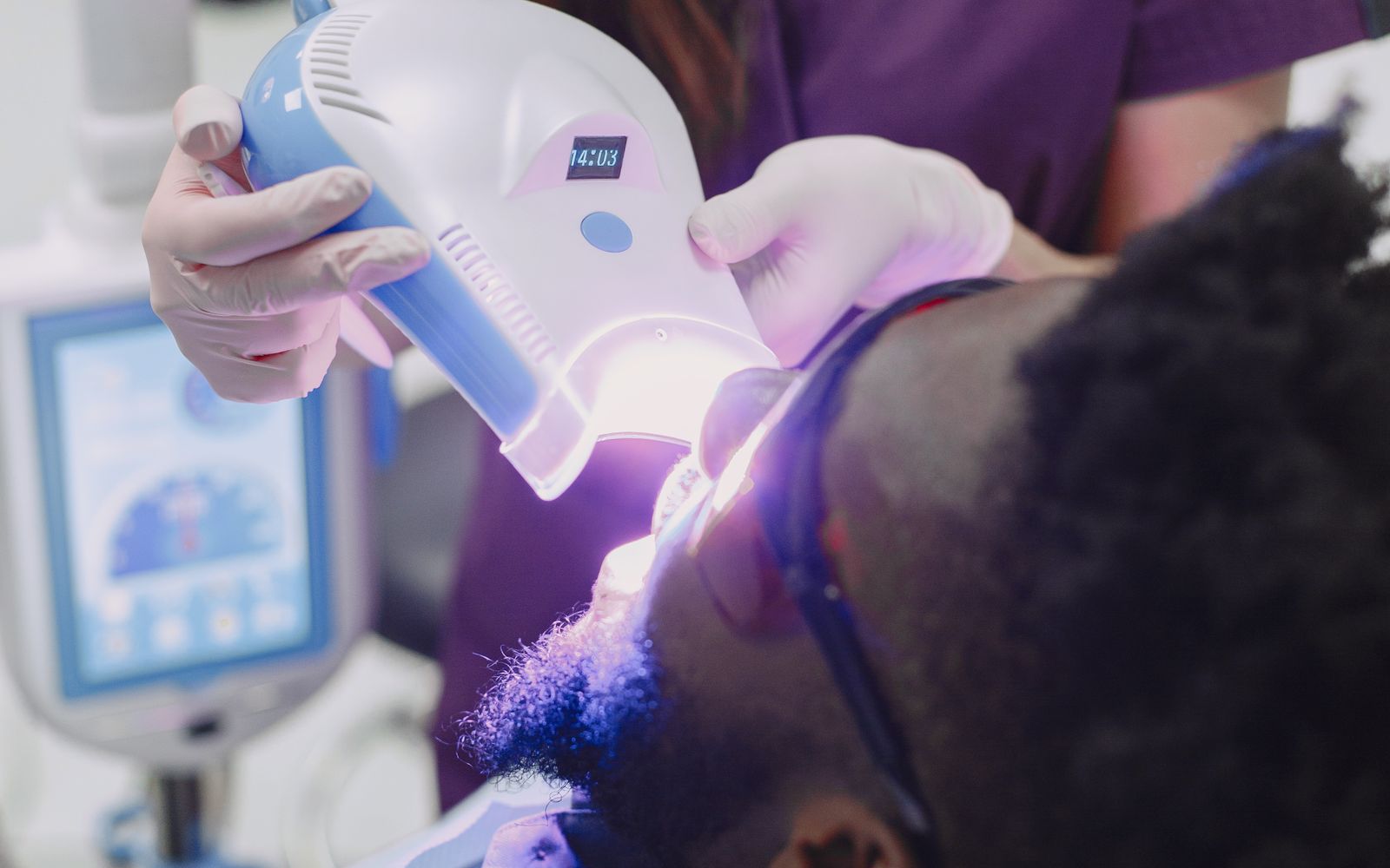 Dentista aplicando luz fotopolimerizadora em restauração